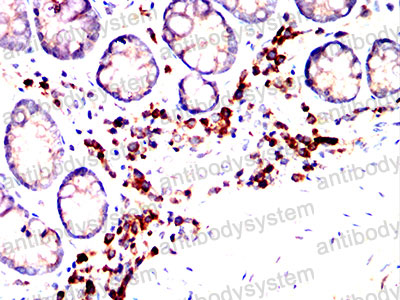 Immunohistochemical for Anti-MMP9 Antibody (R3D69) ?>