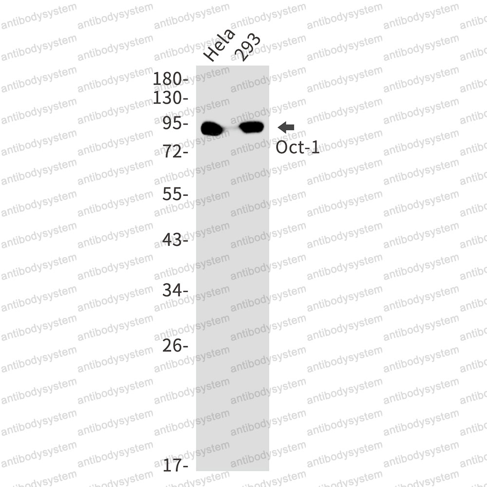 Anti-POU2F1 Antibody (R1P51)
