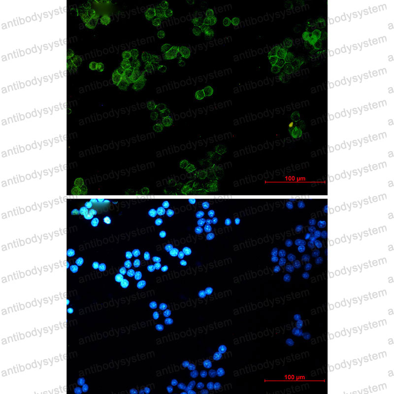 Anti-JUP Antibody (R1P55)