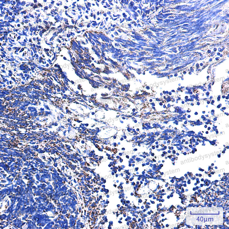 Anti-UQCRB Antibody (R1P56)