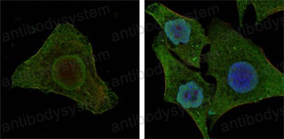 Immunofluorescence for Anti-BRAF/B-Raf Antibody (R3D79) ?>