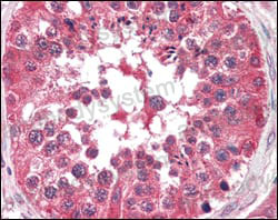 Immunohistochemical for Anti-BRAF/B-Raf Antibody (R3D79) ?>