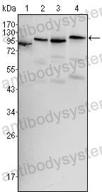 Western blot for Anti-BRAF/B-Raf Antibody (R3D79) ?>