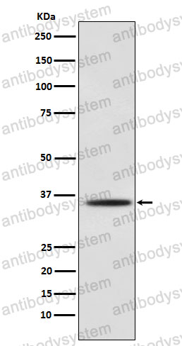 Anti-MYOG Antibody (R1P62)