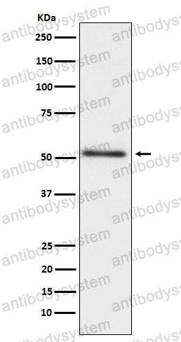 Anti-ACP3 Antibody (R1P66)
