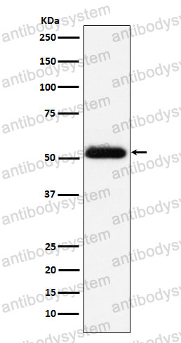 Anti-ACP3 Antibody (R1P65)