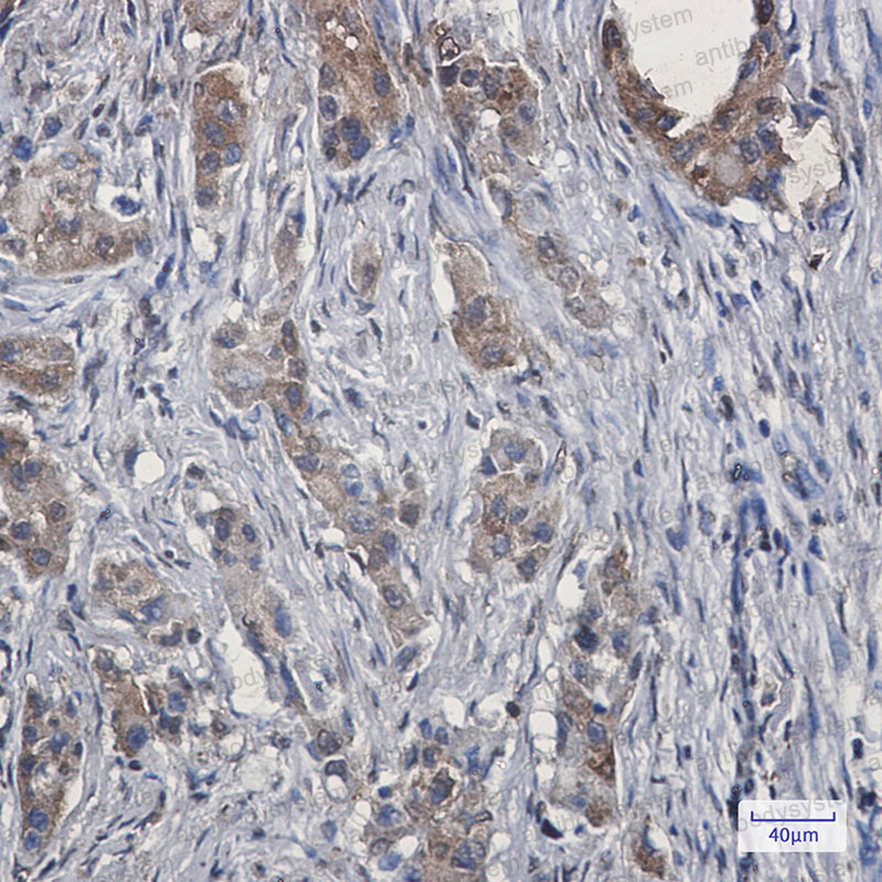 Anti-EZR Antibody (R1P68)