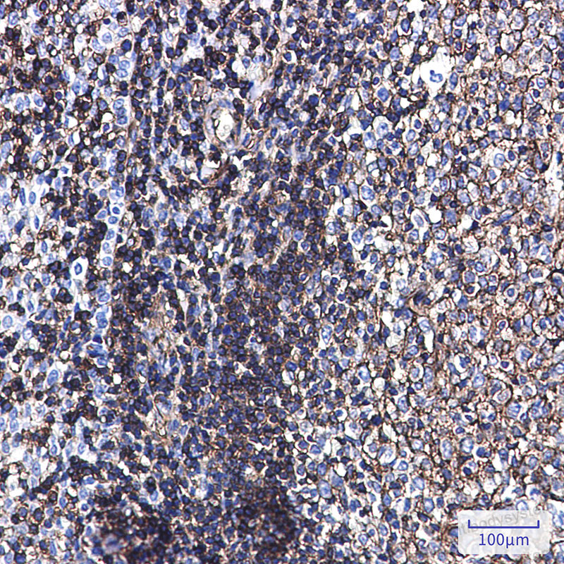 Anti-Phospho-EZR/Moesin (Thr567/Thr564/Thr558) Antibody (R1P67)