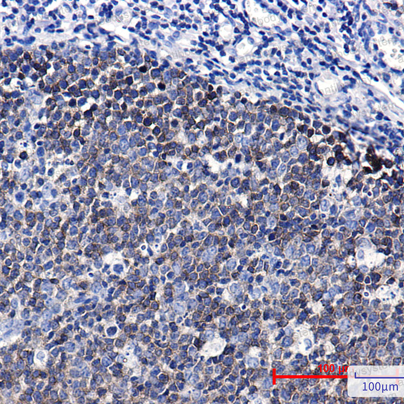 Anti-EZR Antibody (R1P69)