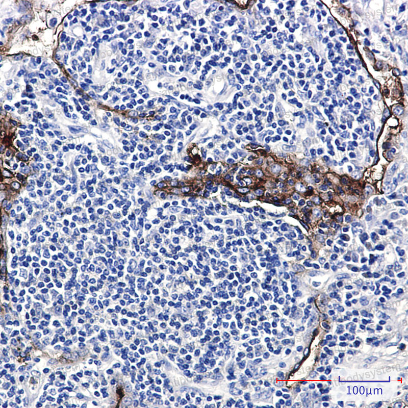 Anti-FOLR1 Antibody (R1P70)