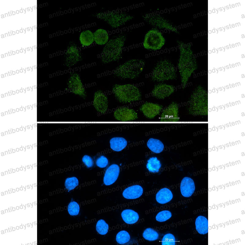 Anti-ATF2 Antibody (R1P72)