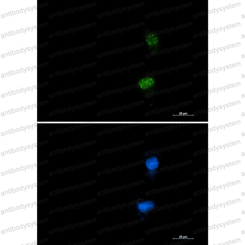 Anti-Phospho-ATF2 (Thr71) Antibody (R1P71)