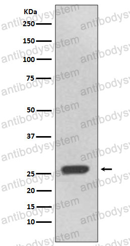 Anti-UCHL3 Antibody (R1B01)