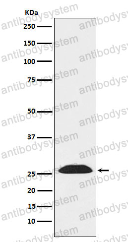 Anti-UCHL3 Antibody (R1P74)