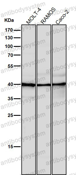 Anti-FOSL1 Antibody (R1P75)