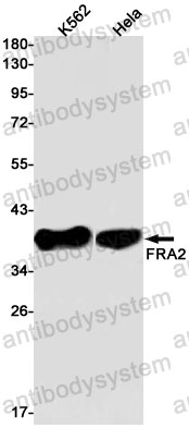 Anti-FOSL2 Antibody (R1P77)