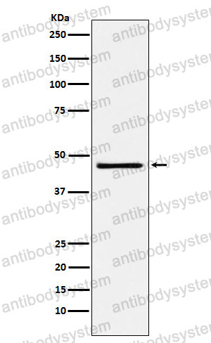 Anti-FOSL2 Antibody (R1P76)