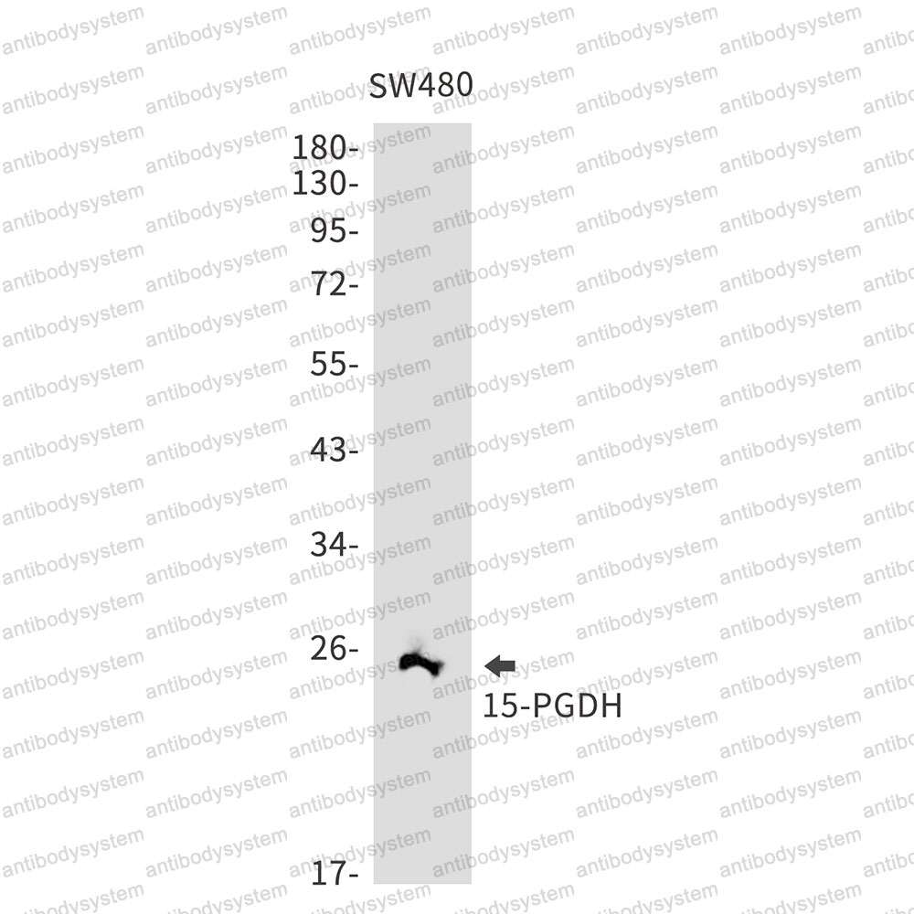 Anti-HPGD Antibody (R1P79)