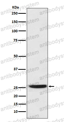 Anti-HPGD Antibody (R1P78)