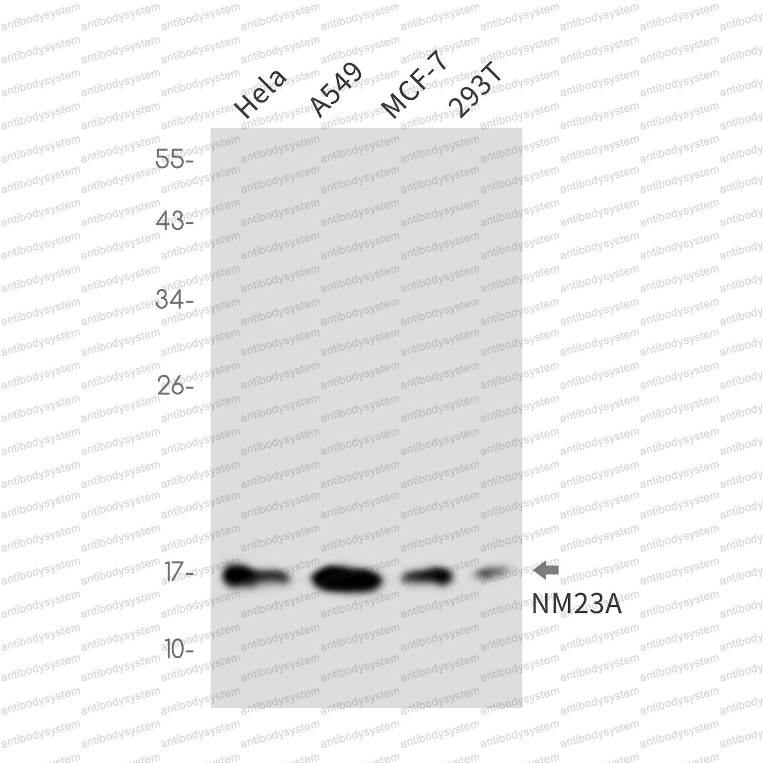 Anti-NME1 Antibody (R1P81)
