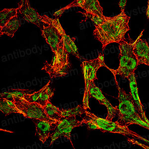 Immunofluorescence for Anti-NQO1 Antibody (R3E11) ?>