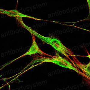 Immunofluorescence for Anti-NQO1 Antibody (R3E11) ?>