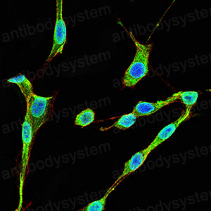 Immunofluorescence for Anti-NQO1 Antibody (R3E11) ?>