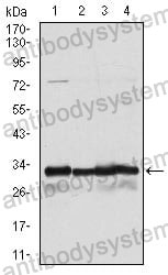 Western blot for Anti-NQO1 Antibody (R3E11) ?>