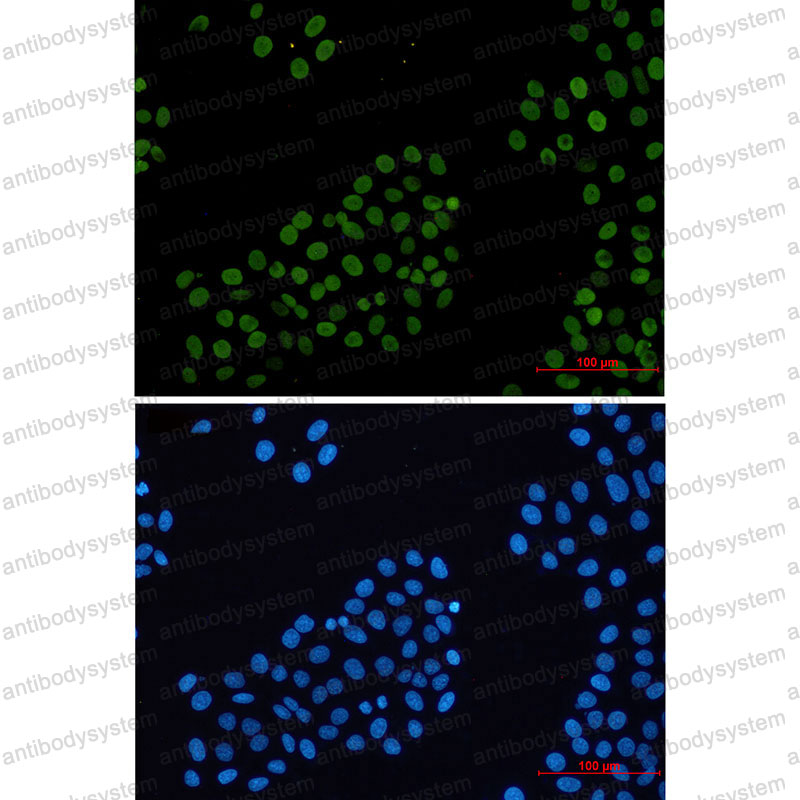 Anti-H2AX Antibody (R1P93)