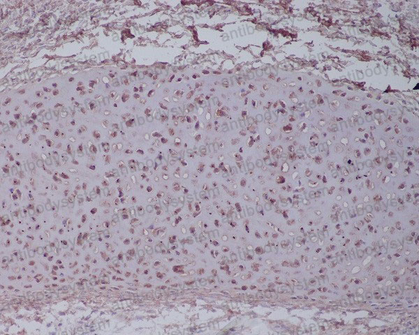 Anti-ACAN Antibody (R1P94)