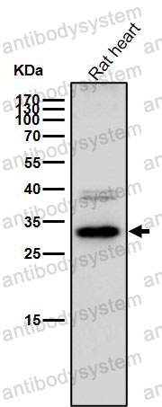 Anti-CBR1 Antibody (R1B50)
