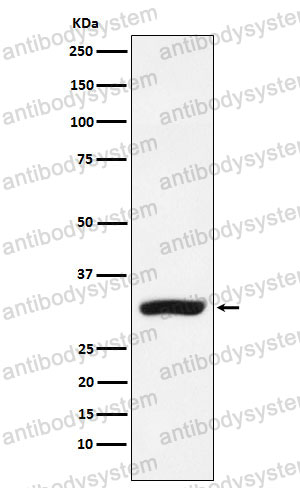 Anti-CBR1 Antibody (R1P95)