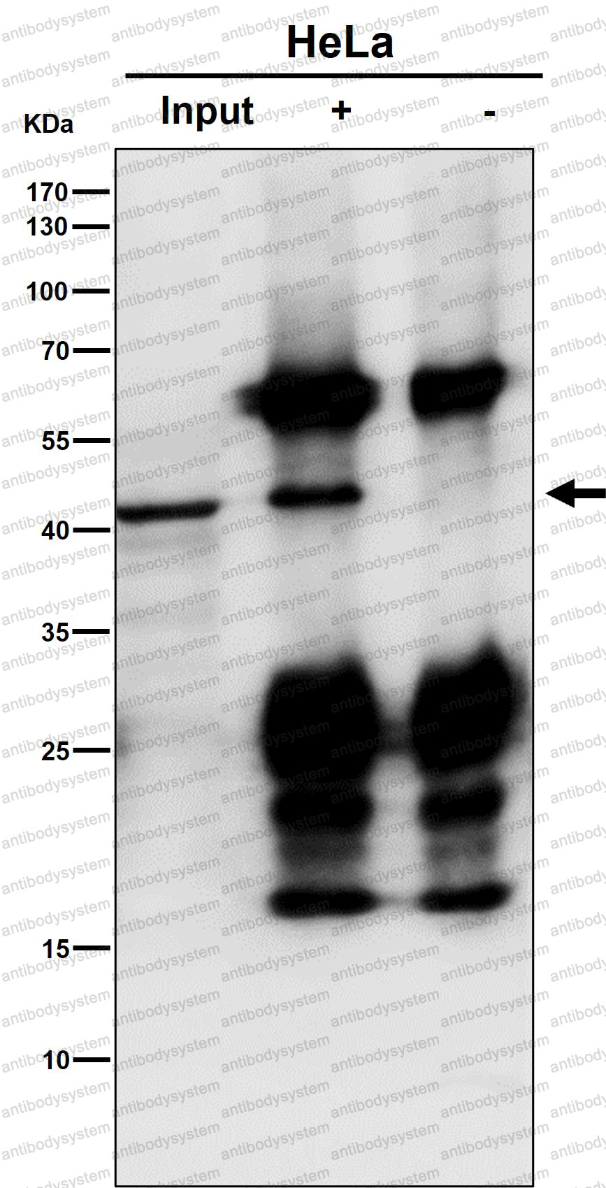 Anti-ACADS/SCAD Antibody (R1P96)