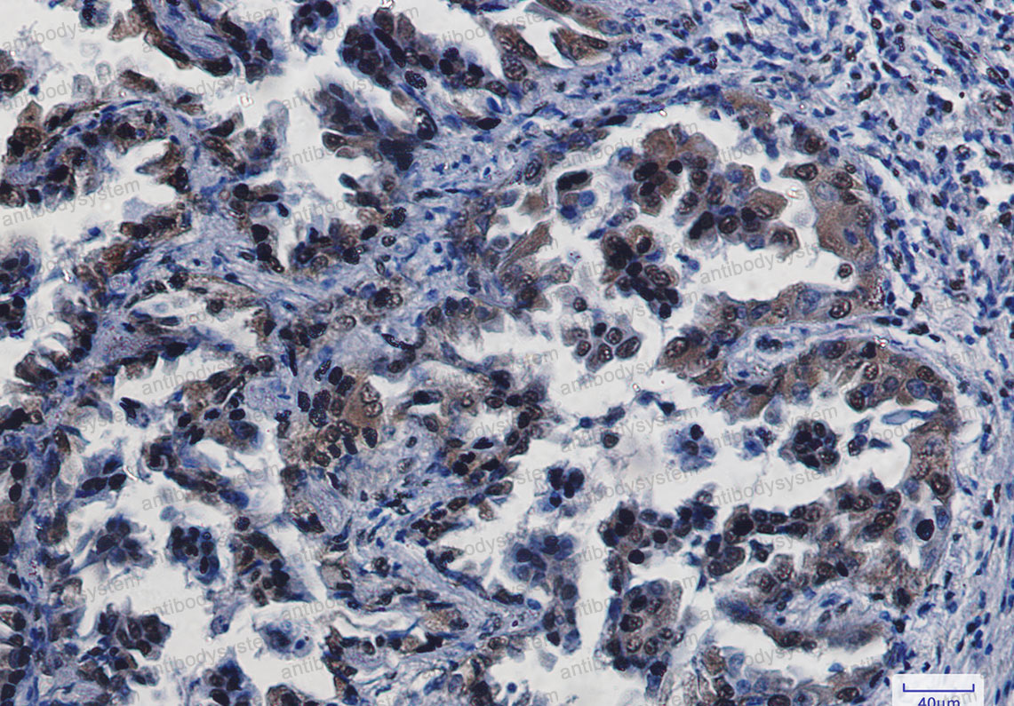 Anti-CREB1 Antibody (R1P99)