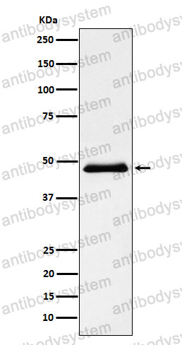 Anti-PNLIP Antibody (R1Q01)