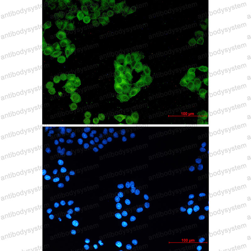 Anti-POR Antibody (R1Q14)
