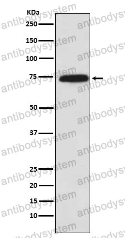 Anti-POR Antibody (R1Q13)
