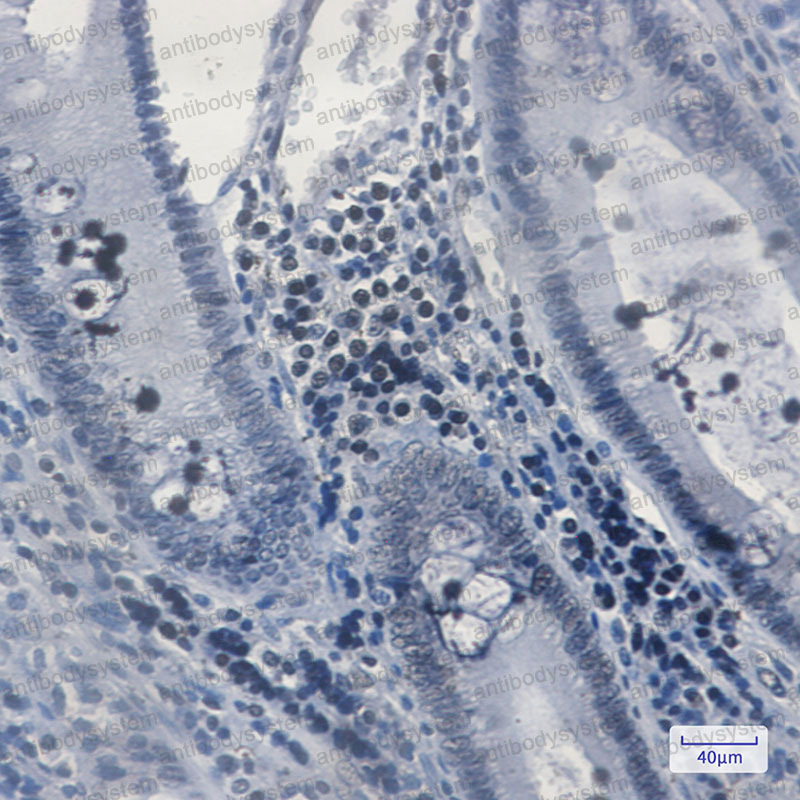 Anti-MGMT Antibody (R1Q16)
