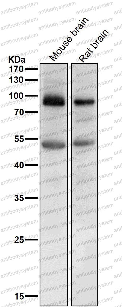 Western blot for Anti-PRLR Antibody (R1Q18) ?>