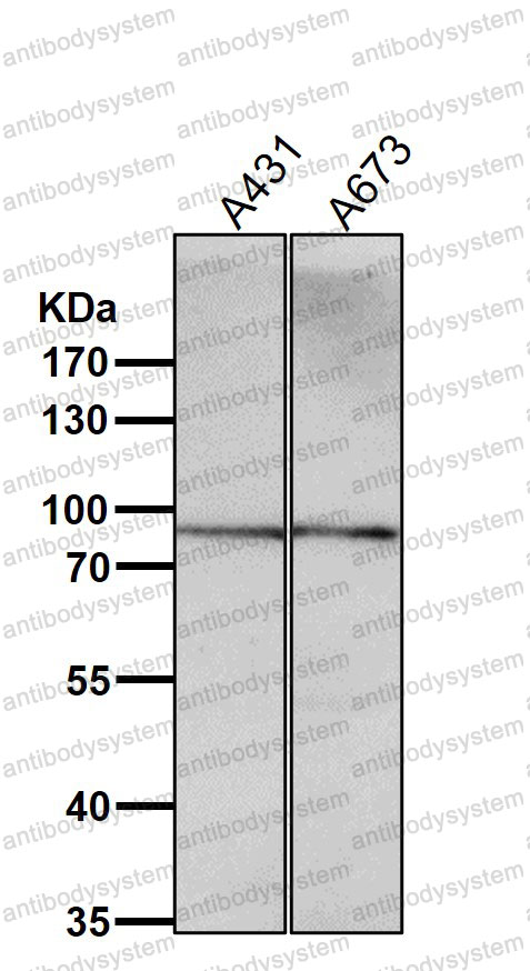 Western blot for Anti-PRLR Antibody (R1Q18) ?>