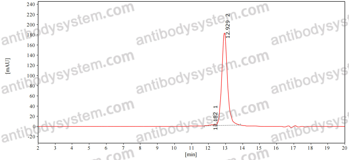 Anti-Human TSHR/LGR3 Antibody (CS-17)