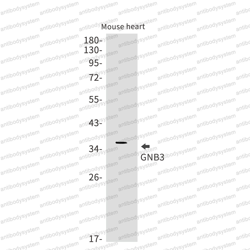 Anti-GNB3 Antibody (R1Q19)