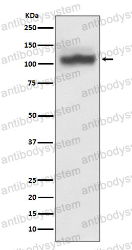 Anti-ATP2A2/SERCA2 Antibody (R1Q20)