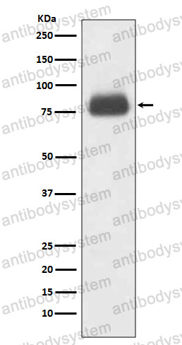 Anti-CD36 Antibody (R1Q22)