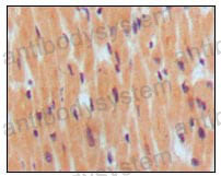 Immunohistochemical for Anti-BNP Antibody (R3E60) ?>
