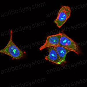 Immunofluorescence for Anti-PLCG2 Antibody (R3E66) ?>
