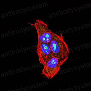 Immunohistochemical for Anti-PLCG2 Antibody (R3E65) ?>