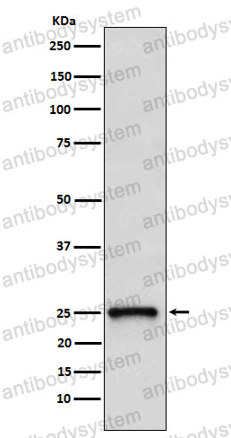 Anti-RHOQ Antibody (R1Q24)