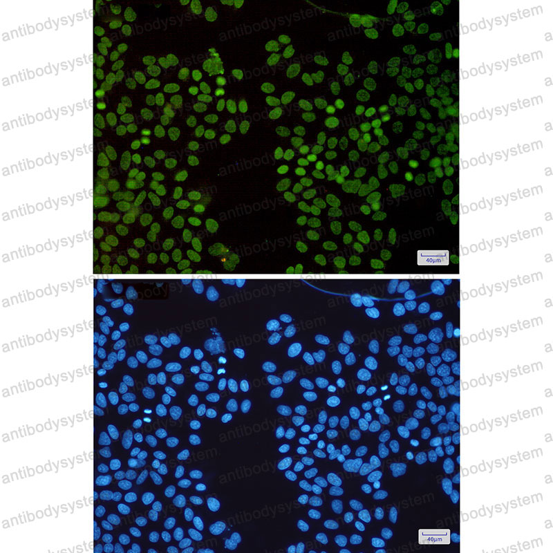 Anti-HMGA1 Antibody (R1Q26)