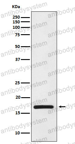 Anti-HMGA1 Antibody (R1Q25)